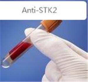 Anti-STK25/YSK1  �z����/�K���ἤø25���w��(y��u)��